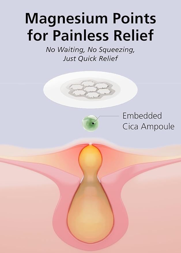 EasyDerm Magnesium Pimple Patches – Hydrocolloid Acne Spot Treatment with Ampoule & Tweezer, 10 Calming Zit Stickers by Daewoong, 이지덤, 대웅제약