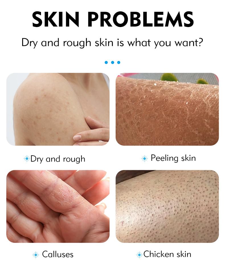 40% Urea Cream plus Salicylic Acid 2%, Anti-Cracking Nourishing and Moisturizing Hand and Foot Cream，Softens Cuticles on Rough Skin of Hands and Feet，3.05 OZ