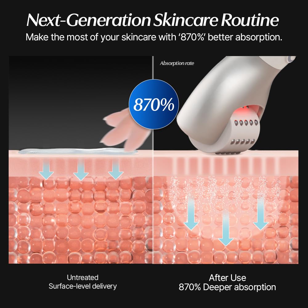 CELORABY Potension Penta-Shot Glass Skin Glow Booster Korean Skin Care Device 5-in-1 Total Care for Enhanced Absorption, Intensive Pore Care, Needle Free, Professional Skincare Comfortably at Home