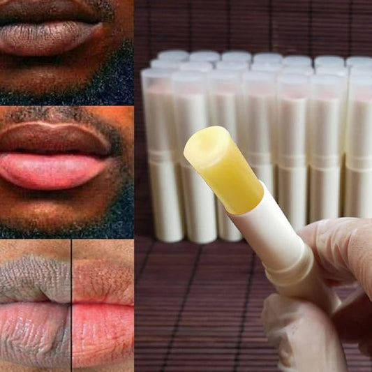 2PCS Handmade Plant lip balm Pink Lips Serum Brighten Dark Lips Bleaching Essence Lip Balm Repair Fine Lines Brighten Moisture Exfoliator Lip Care (Yellow)
