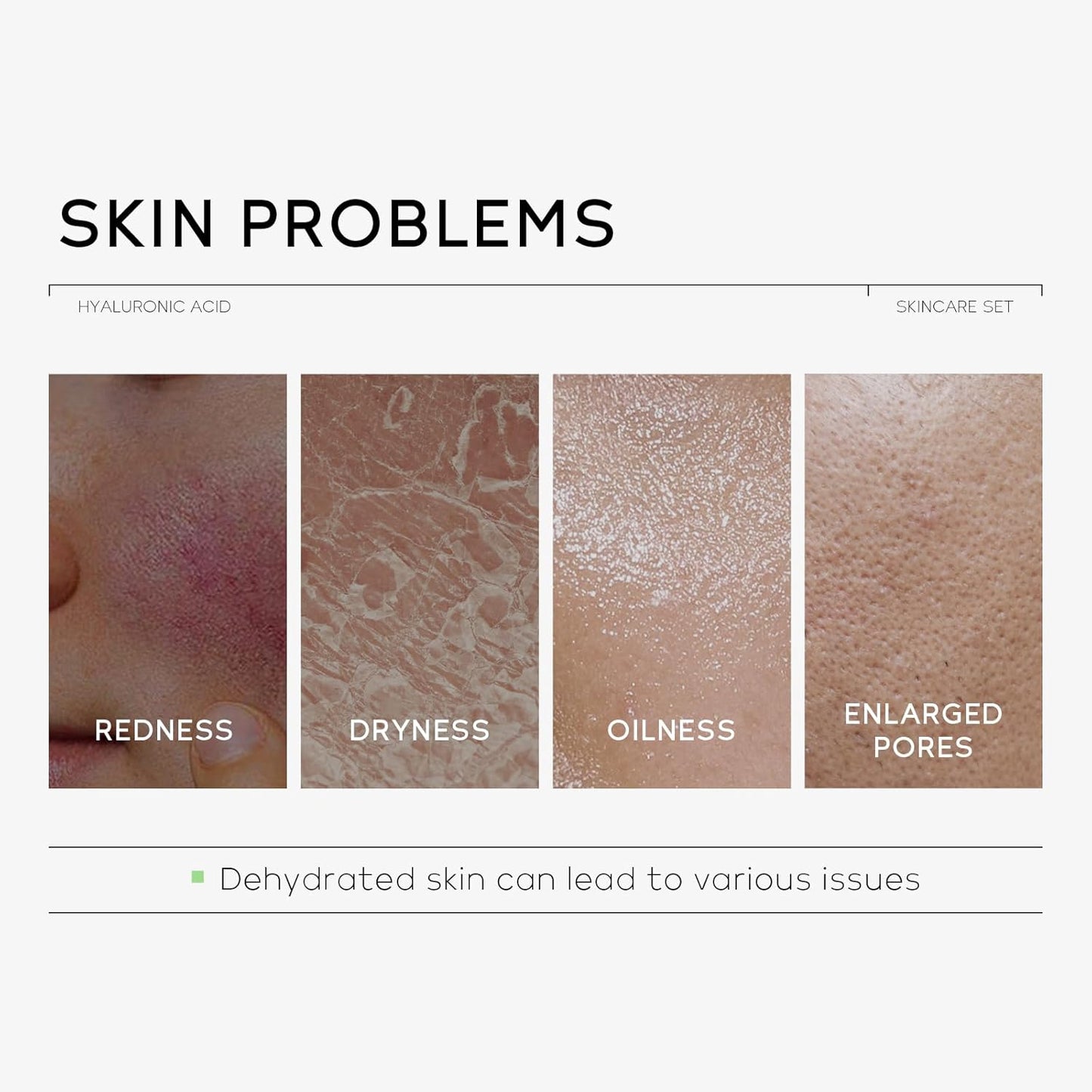 Hyaluronic Acid Skin Care Set, Hydration Kit for Women Teen Girls, Low pH Cleanser, Moisturizer, Serum, Eye Cream, Anti Aging, Firming, Travel Size Facial Care Gift Set for Dry Sensitive Skin