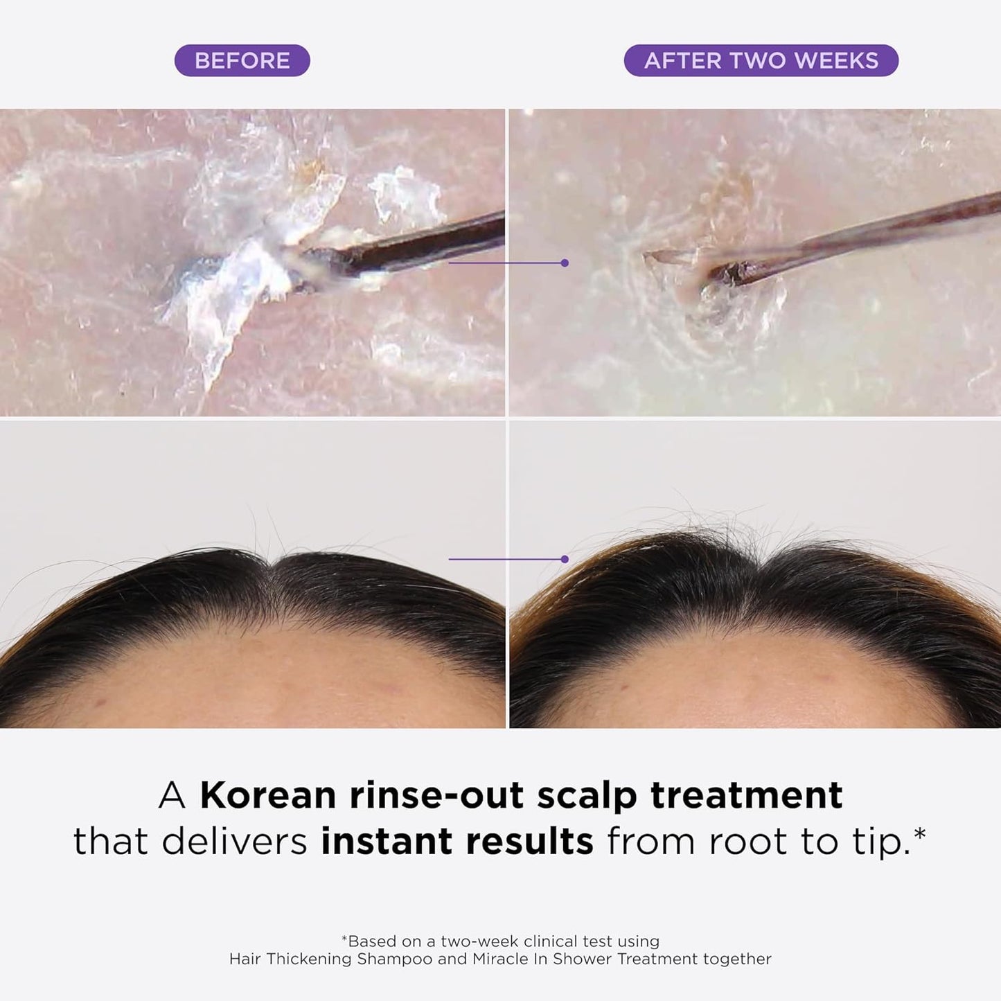 Dr. Groot Miracle in Shower Treatment for Hair Loss, Korean Hair Care, 5 Seconds to Smooth Hair, Rosemary Oil for Healthier-Looking Hair, Hair Rinse, Moisturizing Treatment,Scalp Revitalizing Solution