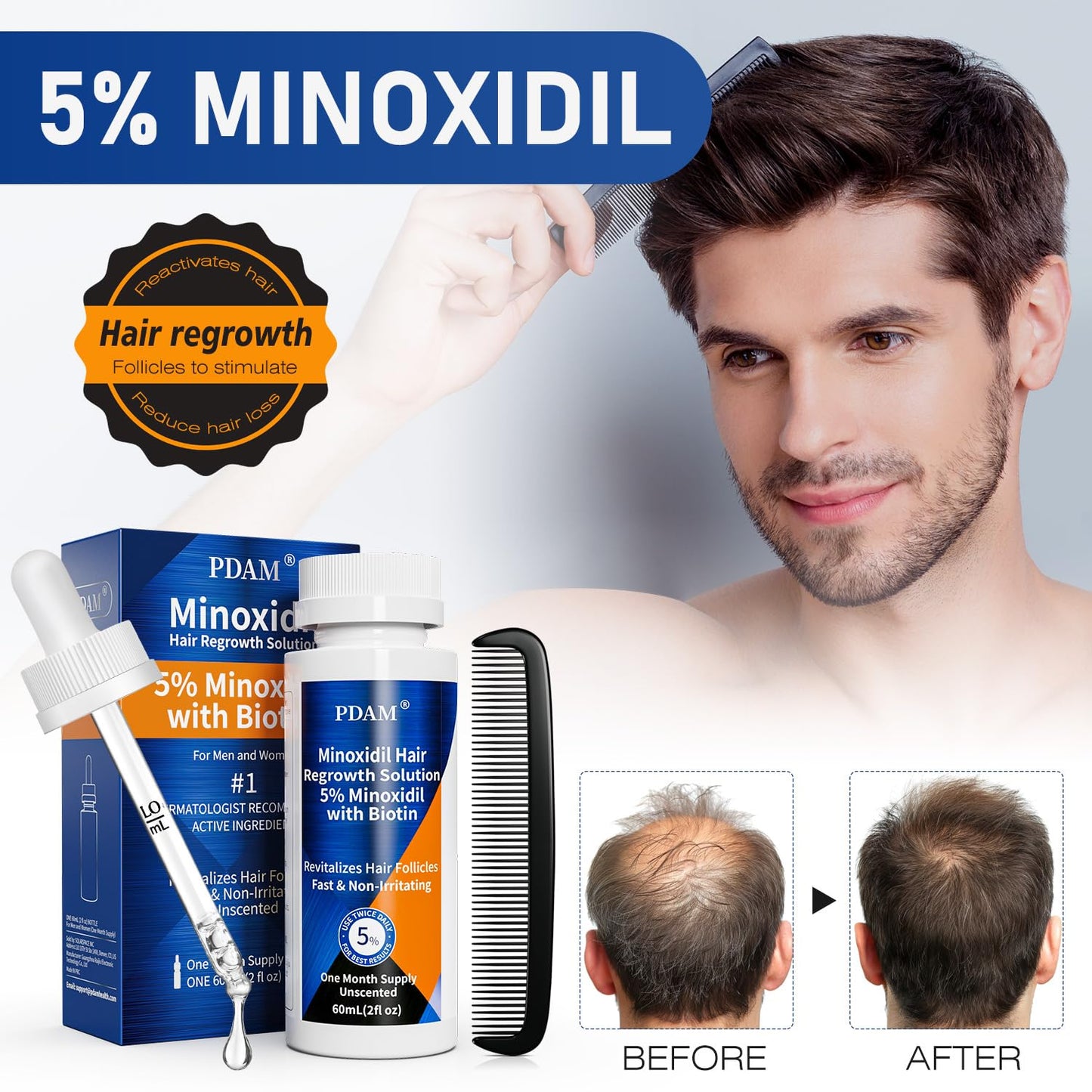 5% Minoxidil for Men Hair & Beard Growth Kit, Minoxidil for Women Hair Growth Serum, Extra Strength Hair Loss Treatment for Thinning Hair, Promotes Thicker Fuller Regrowth, Nourishes Scalp, 2oz