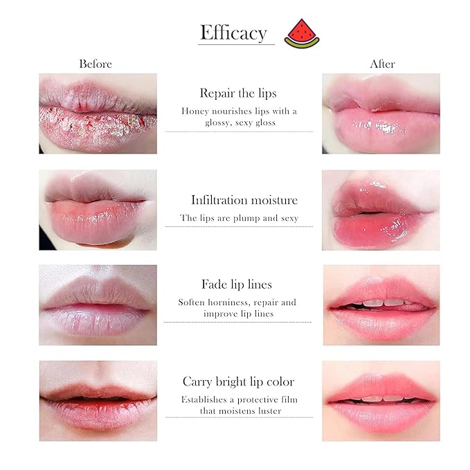 1 PCS Bee Lip Balm Honey Pot, Moisturizing Watermelon Sleeping Lip Balm Lip Mask Overnight, Hydrate Lip Repair Prevent Dry and Cracked Lip Care, Nourishes the Lip Skin, Reduces Lip Lines