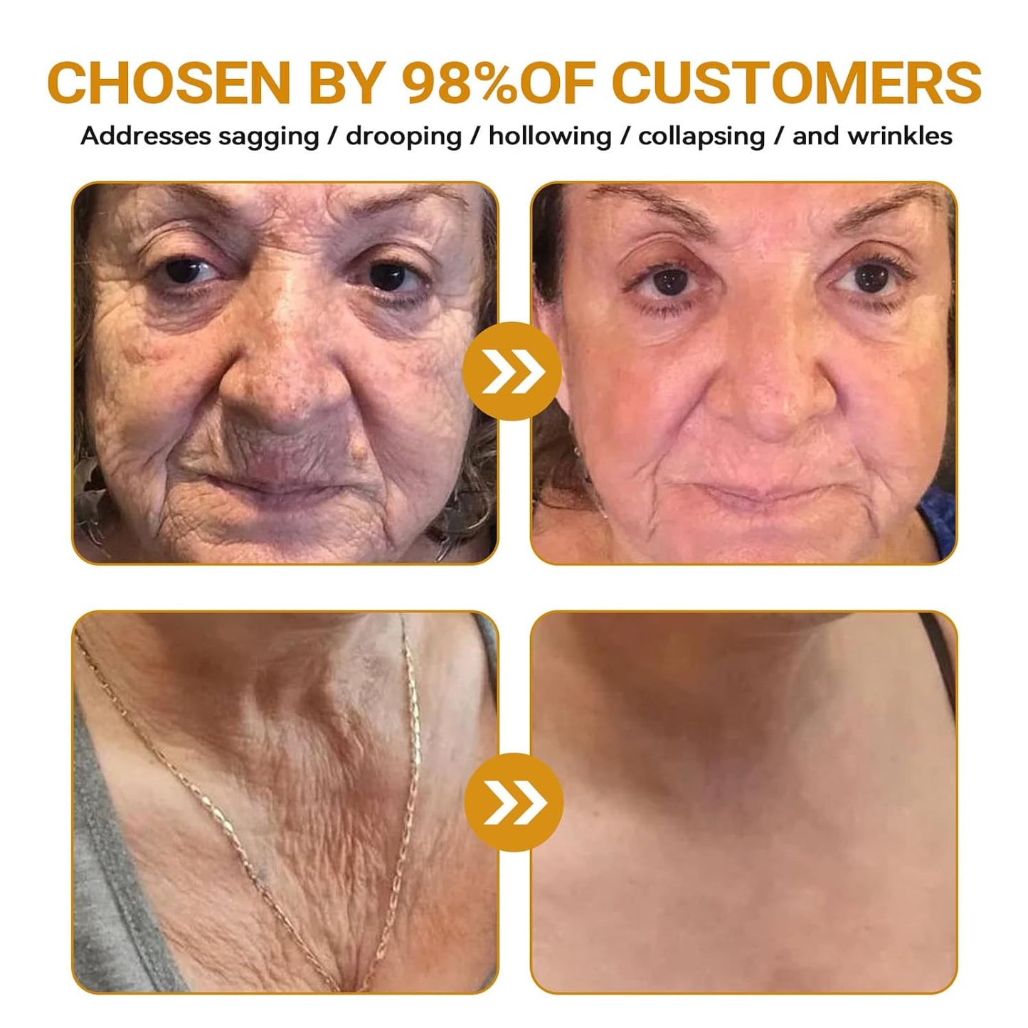 Bee Venom Skin Restoration Cream, Bee Venom Skin Treatment Cream, Repair skin and Firming, Effective In Reducing Blemishes (3)