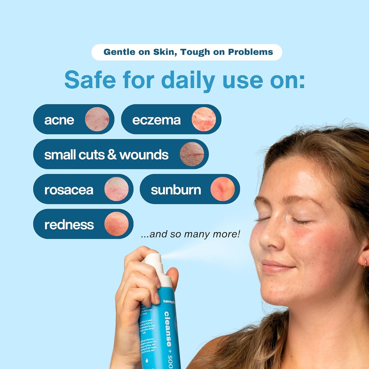 Hypochlorous Acid Spray – HOCl Face & Skin Mist for Acne, Eczema & Irritation – Multi-Purpose Skin Repair – Eyelid Cleanser, Post-Workout, Post-Procedure, Scalp, Sensitive Skin TSA 2 oz