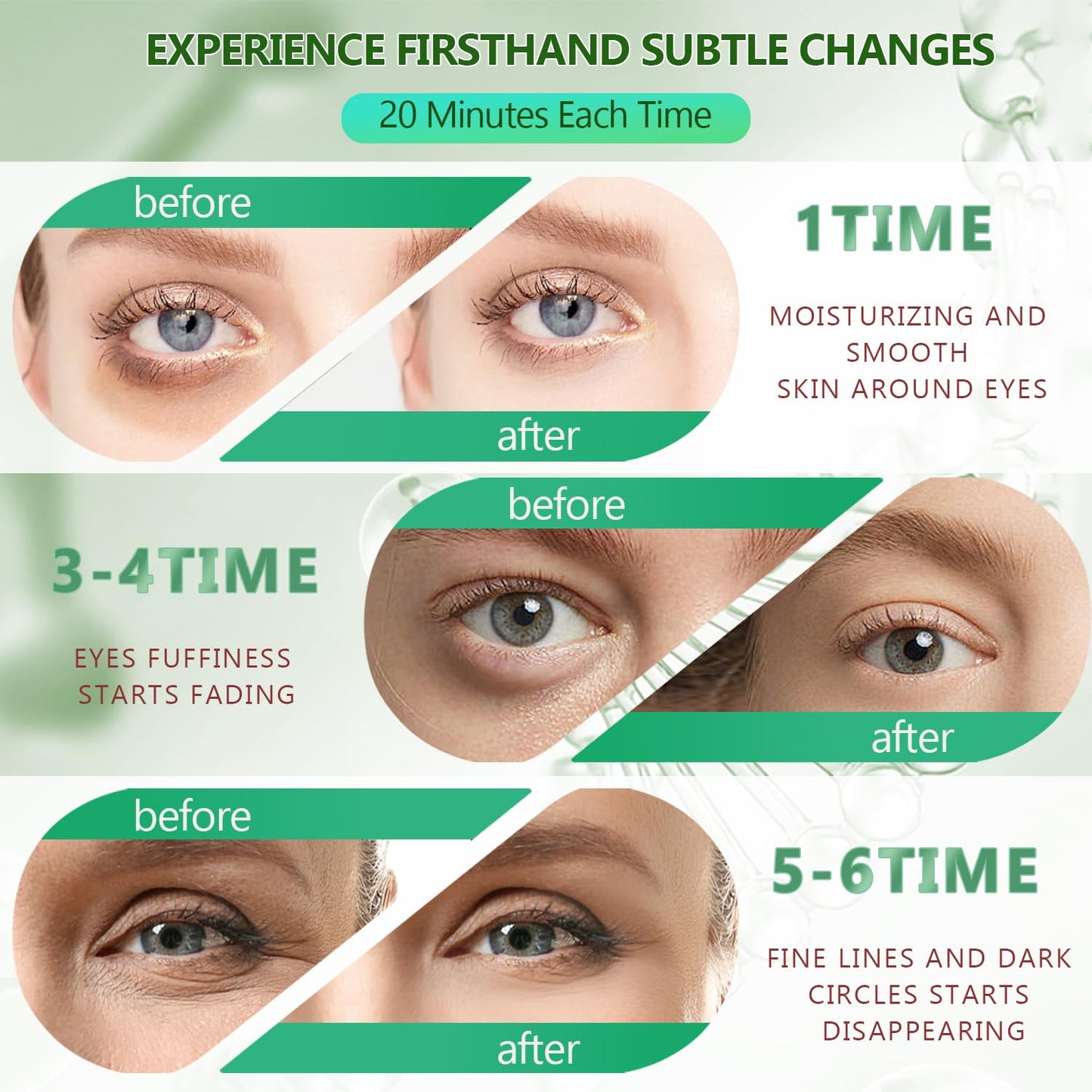 60 Pcs Green Under Eye Patches, 30 Pairs Undereye Mask for Dark Circles Puffy Eyes Treatment, Collagen Gel Pads Hydrating for Eye Bags Puffiness Wrinkle, Women Men Beauty Skin Care Products