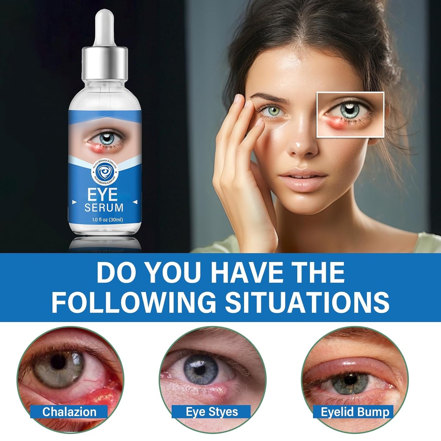 Eye Treatment, Effective Eye Serum for Chalazion and Blepharitis Treatment, 30mL Gentle Lash and Eye Cleanser, Blue