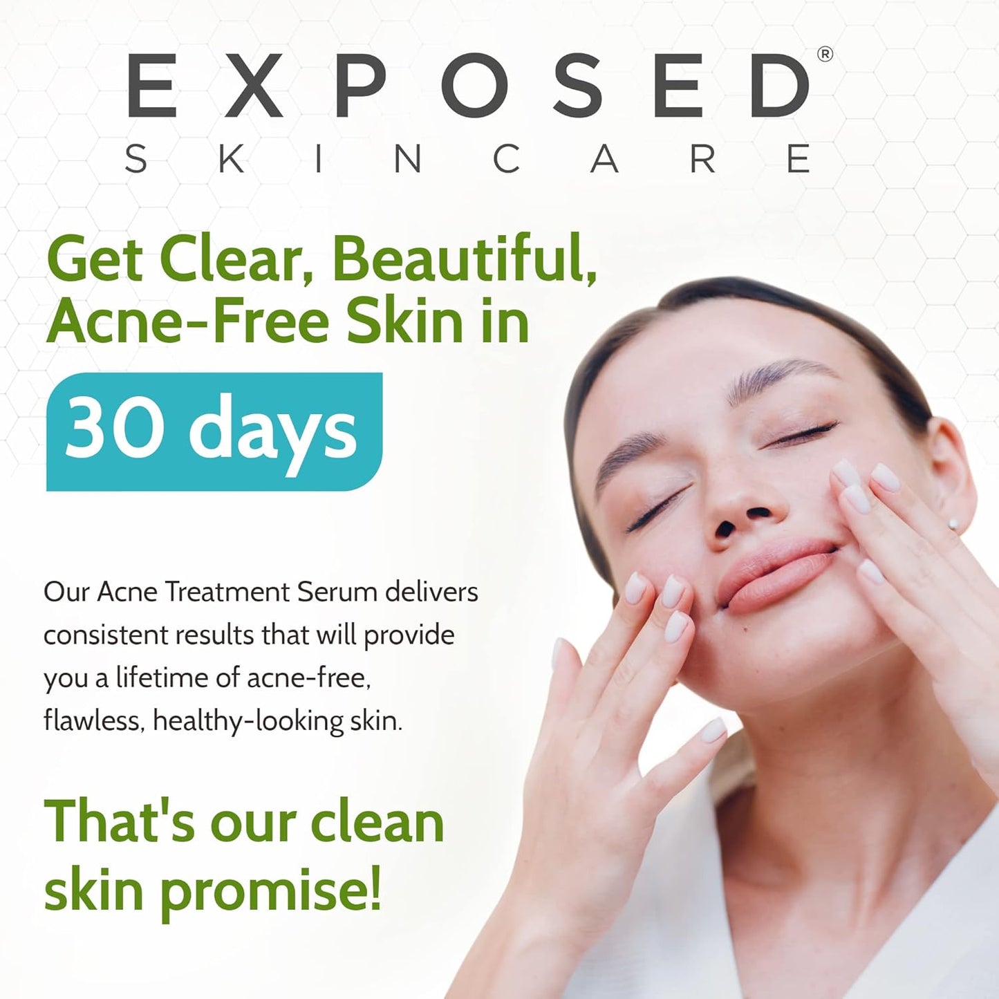 Exposed Skin Care Acne Treatment Serum Step 3 – Quickly Reduces Pimple Size and Redness - 12 Hour Spot Treatment - 3.5% Benzoyl Peroxide, Natural Green Tea & Tea Tree Oil