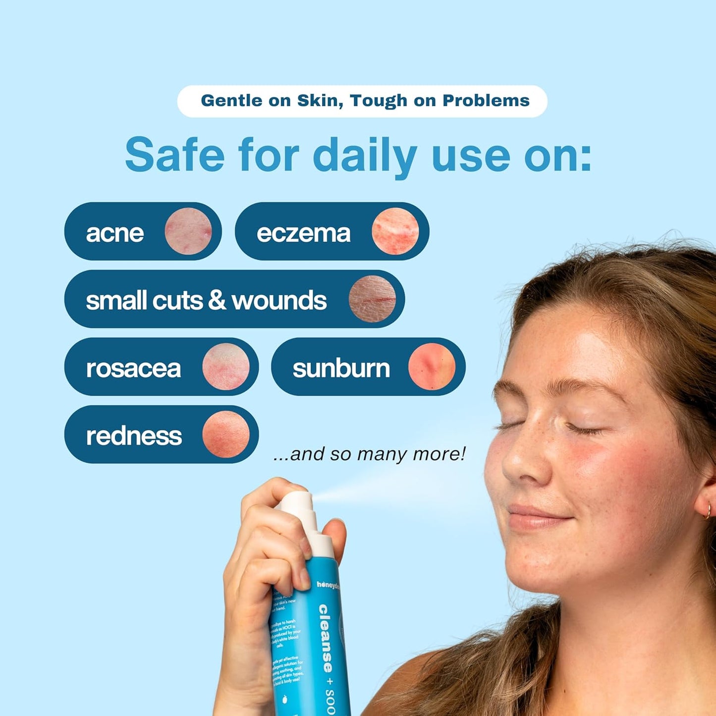 Hypochlorous Acid Spray - HOCL - Hypoallergenic Skin Toner Cleanse and Soothe Sensitive Face - Acne - Eczema - Bacne - Eyelid - Pre Post Workout (Mini Bundle Pack - 2fl + 2 fl)