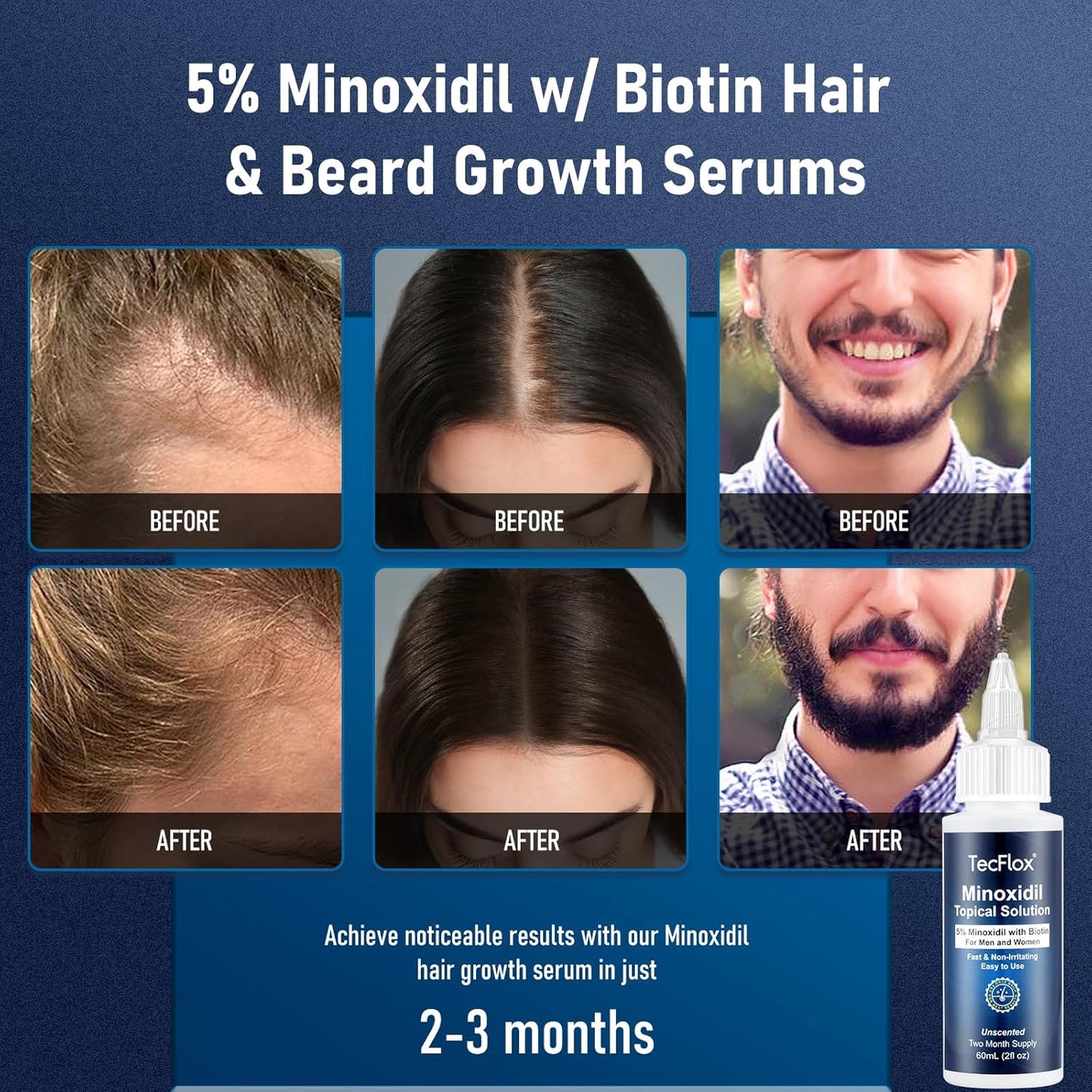 5% Minoxidil with Biotin for Men & Women, Beard Growth Oil, Hair Growth Serum, Unisex, 2-Pack, Total 4 fl oz for 4 Months