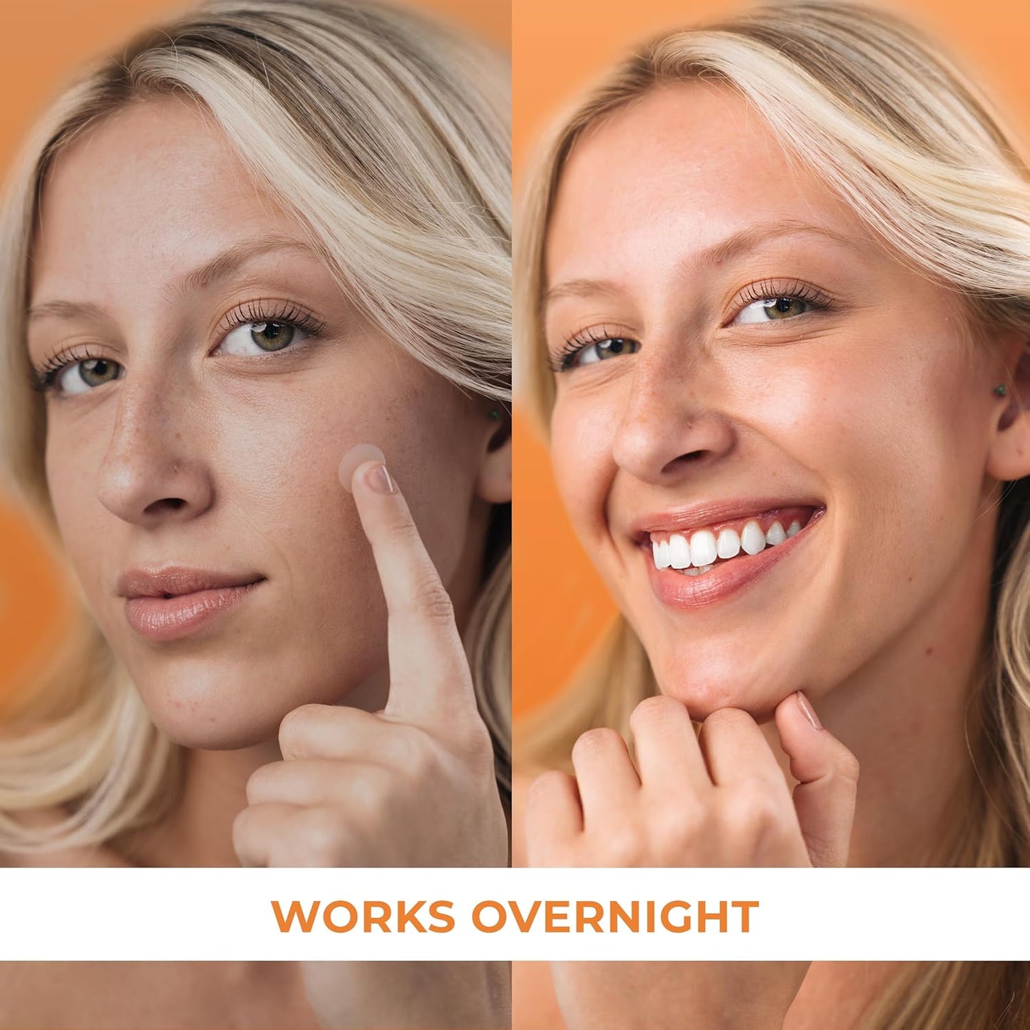 Acne Patches (120 Count), Hydrocolloid Pimple Patches for Face - Zit Patch Acne Dots - Cystic Acne Patches Treatment - Pimple Patch with 3 Size Acne Stickers