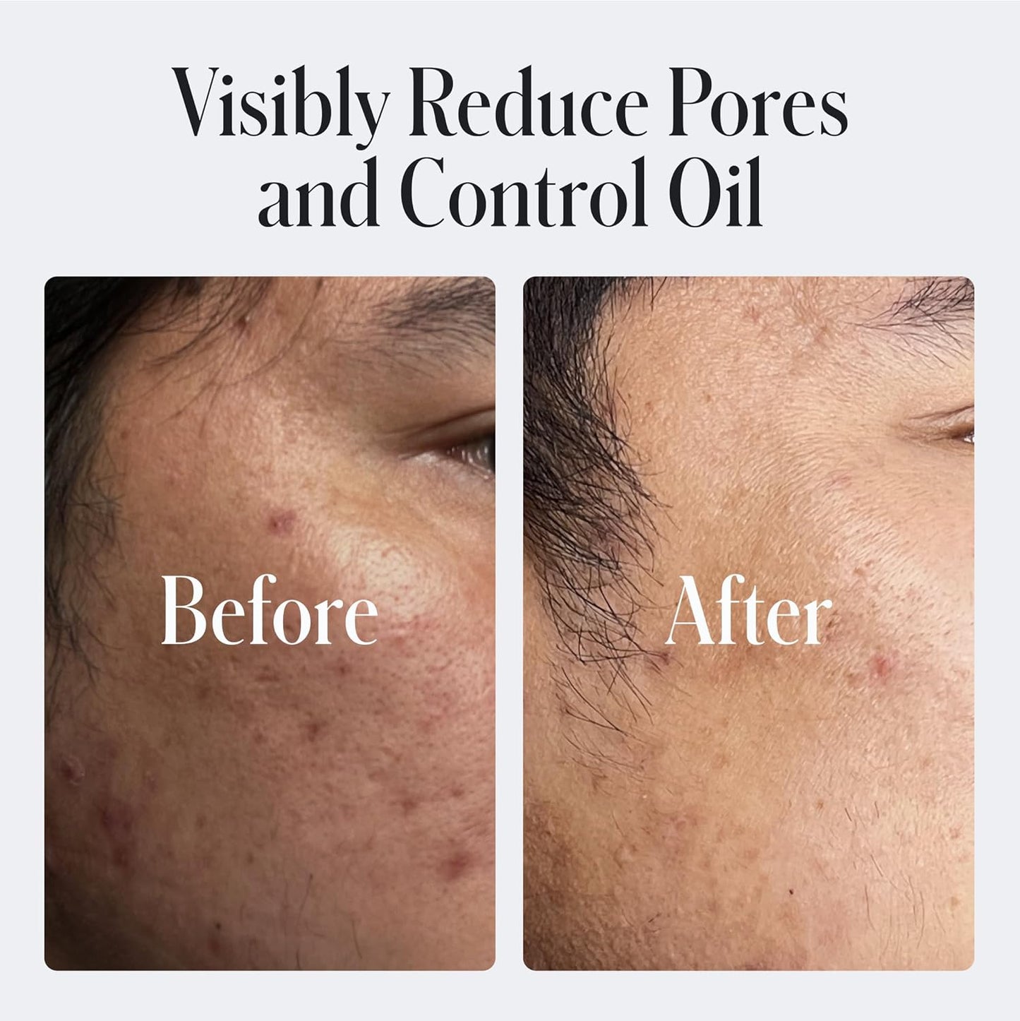 Geologie Daily Face Wash for Sensitive Skin | Fragrance-Free Facial Cleanser for Men & Women | Acne & Oil Control | Non-irritating, Gentle Cleansing & Soothing Face Wash | 2-Pack