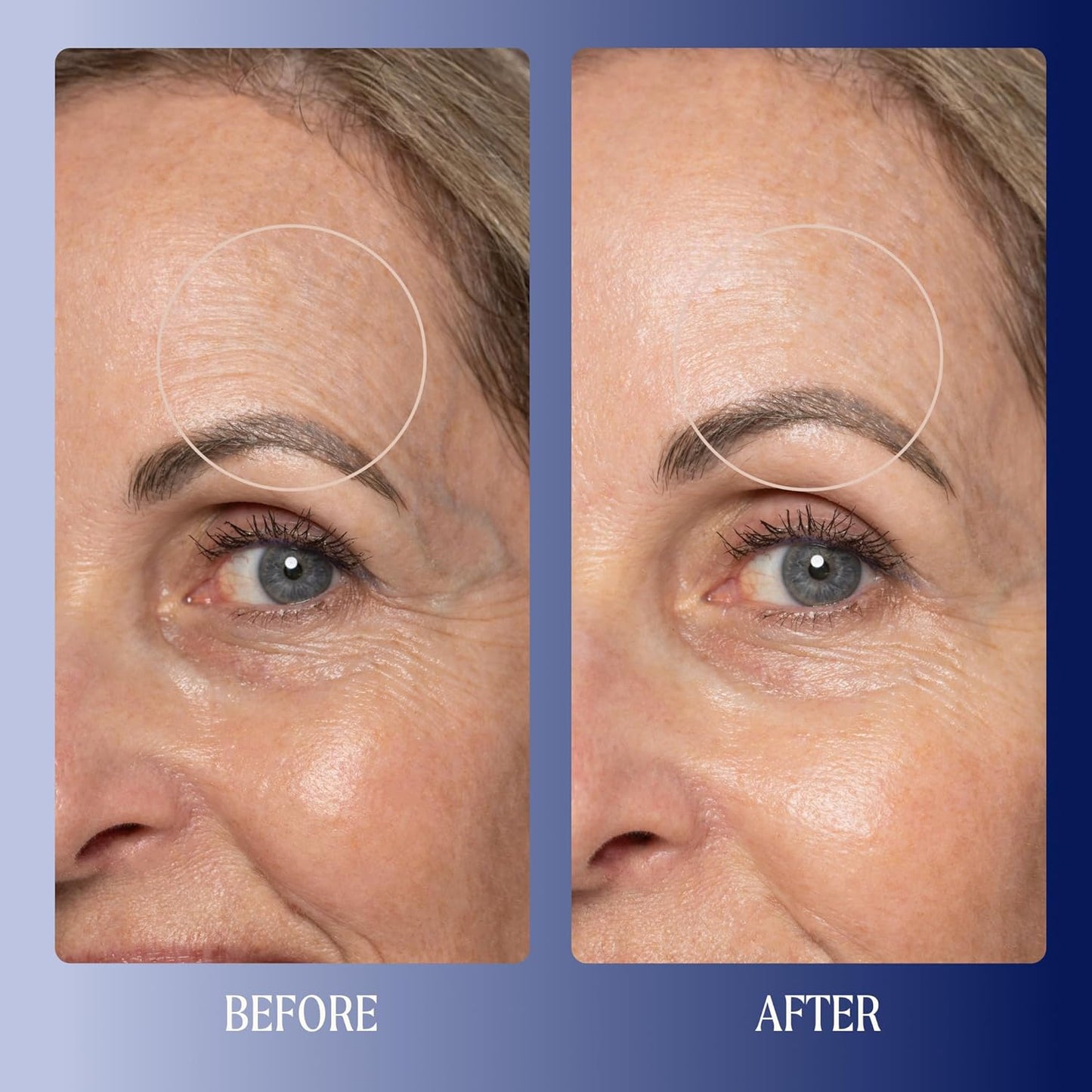 Kinship Super Rich Collagen + Ceramide Firming Cream | Anti Aging, Hydrating Face Moisturizer for Sensitive Skin | Wrinkle Cream - Smooth Fine Lines | Synthetic Fragrance-Free | Derm Approved, (1.7oz)